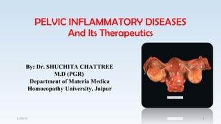 PELVIC INFLAMMATORY DISEASES 
And Its Therapeutics 
By: Dr. SHUCHITA CHATTREE 
M.D (PGR) 
Department of Materia Medica 
Homoeopathy University, Jaipur 
11/09/14 1 
 