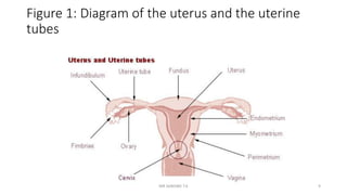 Figure 1: Diagram of the uterus and the uterine
tubes
MR SANDWE T.K 9
 