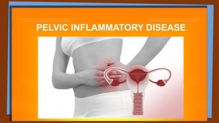 PELVIC INFLAMMATORY DISEASE
 