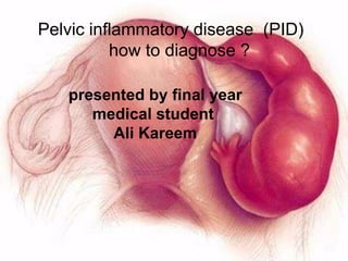 Pelvic inflammatory disease (PID)
how to diagnose ?
presented by final year
medical student
Ali Kareem
 