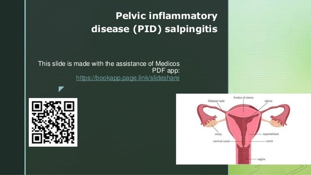 z
This slide is made with the assistance of Medicos
PDF app:
https://bookapp.page.link/slideshare
Pelvic inflammatory
disease (PID) salpingitis
 