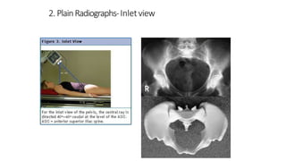 Pelvic injuries | PPTX