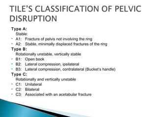 Type A:
Stable:
 A1: Fracture of pelvis not involving the ring
 A2: Stable, minimally displaced fractures of the ring
Type B:
Rotationally unstable, vertically stable
 B1: Open book
 B2: Lateral compression, ipsilateral
 B3: Lateral compression, contralateral (Bucket’s handle)
Type C:
Rotationally and vertically unstable
 C1: Unilateral
 C2: Bilateral
 C3: Associated with an acetabular fracture
 