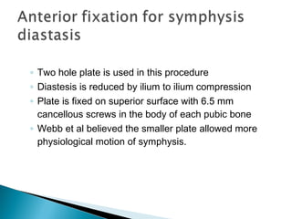 ◦ Two hole plate is used in this procedure
◦ Diastesis is reduced by ilium to ilium compression
◦ Plate is fixed on superior surface with 6.5 mm
cancellous screws in the body of each pubic bone
◦ Webb et al believed the smaller plate allowed more
physiological motion of symphysis.
 