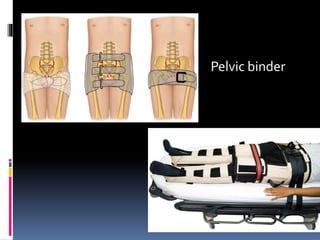 Pelvic binder 
 