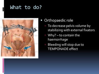 What to do? 
 Orthopaedic role 
 To decrease pelvis volume by 
stabilizing with external fixators 
 Why? – to contain the 
haemorrhage 
 Bleeding will stop due to 
TEMPONADE effect 
 