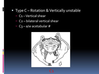  Type C – Rotation & Vertically unstable 
 C1 –Vertical shear 
 C2 – bilateral vertical shear 
 C3 – a/w acetabular # 
C1 
 