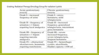 Grading: RadiationTherapy Oncology Group for radiation cystitis
 