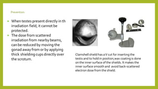  When testes present directly in the
irradiation field, it cannot be
protected.
 The dose from scattered
irradiation from nearby beams,
can be reduced by moving the
gonad away from or by applying
thick shielding cups directly over
the scrotum.
Clamshell shield has aV cut for inserting the
testis and to hold in position,wax coating is done
on the inner surface of the shields. It makes the
inner surface smooth and avoid back-scattered
electron dose from the shield.
Prevention:
 