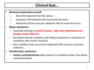 Clinical feat…
• Bimanual examination reveals
o Mass felt separate from the uterus
o A groove is felt between the uterus and the mass.
o Movement of the mass per abdomen fails to move the cervix
• Meig’s Syndrome:-
– classically defined as triad of Ascites , right side hydrothorax and
benign ovarian fibroma.
– Key feature found in patients with Meig’s Syndrome is resolution of
symptoms after tumor resection.
– Rare condition that can only be diagnosed after ovarian carcinoma
ruled out.
• Pseudomeig’s syndrome:-
– Ascites and hydrothorax when present in conditions other than those
mentioned above.
49
 