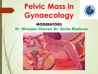 Pelvic Mass in
Gynaecology
MODERATORS
Dr. Niranjan Chavan, Dr. Sarita Bhalerao
 