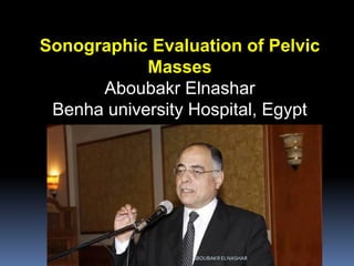 Sonographic Evaluation of Pelvic
Masses
Aboubakr Elnashar
Benha university Hospital, Egypt
ABOUBAKR ELNASHAR
 