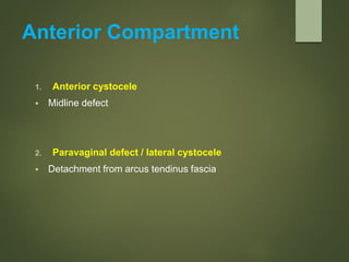 Anterior Compartment
1. Anterior cystocele
 Midline defect
2. Paravaginal defect / lateral cystocele
 Detachment from arcus tendinus fascia
 
