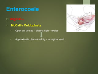 Enterocoele
 Vaginal –
1. McCall’s Culdoplasty
 Open cul de sac – dissect high – excise
 Approximate uterosacral lig – to vaginal vault
 
