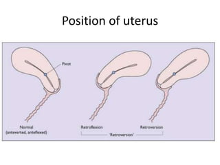Pelvic organ prolapse | PPTX
