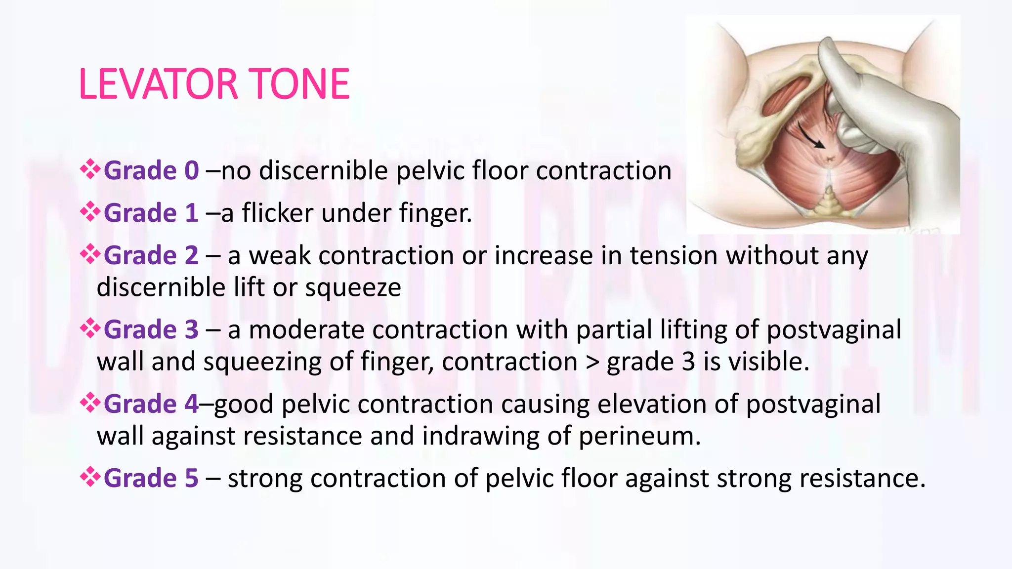 Pelvic organ prolapse | PPTX