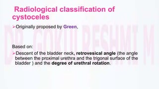 Proctocyle Pelvic organ prolapse | PPTX