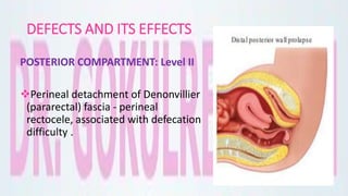 DEFECTS AND ITS EFFECTS
POSTERIOR COMPARTMENT: Level II
Perineal detachment of Denonvillier
(pararectal) fascia - perineal
rectocele, associated with defecation
difficulty .
 