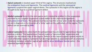 Apical cystocele is located upper third of the vagina. The structures involved are
the endopelvic fascia and ligaments. The cardinal ligaments and the uterosacral
ligaments suspend the upper vaginal-dome. The cystocele in this region of the vagina is
thought to be due to a cardinal ligament defect.
Medial cystocele forms in the mid-vagina and is related to a defect in the suspension
provided by to a sagittal suspension system defect in the uterosacral ligaments
and pubocervical fascia. The pubocervical fascia may thin or tear and create the cystocele.
An aid in diagnosis is the creation of a 'shiny' spot on the epithelium of the vagina. This
defect can be assessed by MRI.
Lateral cystocele forms when both the pelviperineal muscle and its ligamentous–fascial
develop a defect. The ligamentous– fascial creates a 'hammock-like' suspension and
support for the lateral sides of the vagina. Defects in this lateral support system results in
a lack of bladder support. Cystocele that develops laterally is associated with an anatomic
imbalance between anterior vaginal wall and the arcus tendineus fasciae pelvis – the
essential ligament structure.
 
