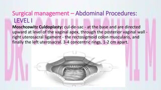 Surgical management – Abdominal Procedures:
LEVEL I
Moschcowitz Culdoplasty: cul-de-sac - at the base and are directed
upward at level of the vaginal apex, through the posterior vaginal wall -
right uterosacral ligament - the rectosigmoid colon muscularis, and
finally the left uterosacral. 3-4 concentric rings, 1-2 cm apart.
 