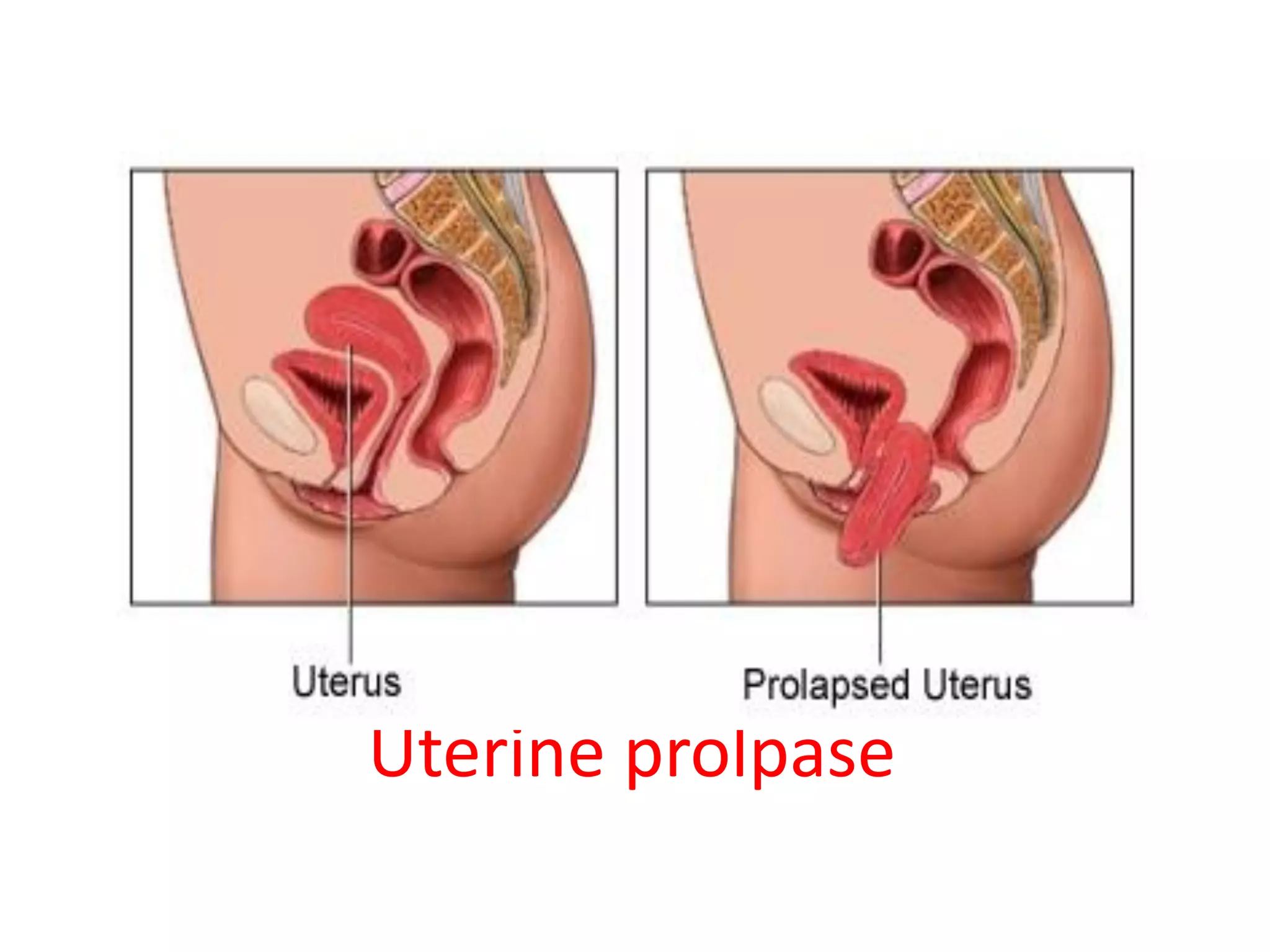 Sauna yoki hammomda jinsiy aloqa (xususiy) Rus viola jinsiy aloqa