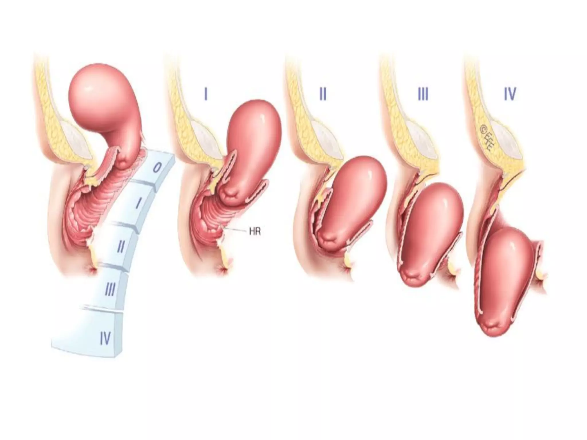 Yalangoch yosh kokraklar Katta suratlar bilan jinsiy aloqa