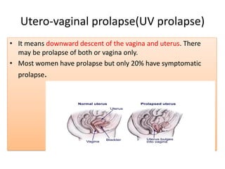 Pelvic organ prolapse Dr H.K.Cheema | PDF