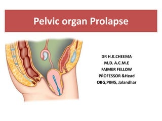 Pelvic organ Prolapse
DR H.K.CHEEMA
M.D. A.C.M.E
FAIMER FELLOW
PROFESSOR &Head
OBG,PIMS, Jalandhar
 