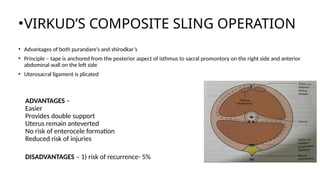 Left Promontory PELVIC ORGAN PROLAPSE final.pptx sssssssss | PPTX