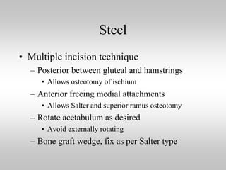 Steel
• Multiple incision technique
– Posterior between gluteal and hamstrings
• Allows osteotomy of ischium

– Anterior freeing medial attachments
• Allows Salter and superior ramus osteotomy

– Rotate acetabulum as desired
• Avoid externally rotating

– Bone graft wedge, fix as per Salter type

 