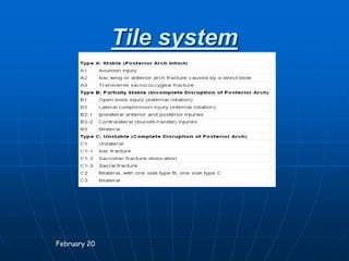Tile system
February 20
 