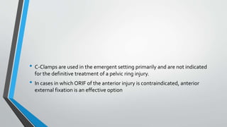 • C-Clamps are used in the emergent setting primarily and are not indicated
for the definitive treatment of a pelvic ring injury.
• In cases in which ORIF of the anterior injury is contraindicated, anterior
external fixation is an effective option
 