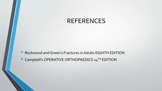 REFERENCES
• Rockwood and Green’s Fractures in Adults EIGHTH EDITION
• Campbell’s OPERATIVE ORTHOPAEDICS 14TH EDITION
 