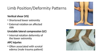 physical findings in pelvic ring injury.pptx
