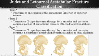 Letronel Classification Pelvic trauma | PPTX