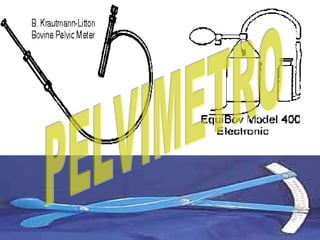 Pelvimetria | PPT