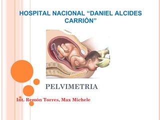 HOSPITAL NACIONAL “DANIEL ALCIDES
             CARRIÓN”




           PELVIMETRIA
Int. Remón Torres, Max Michele
 