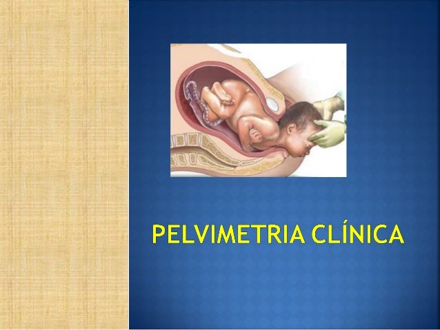 Pelvimetria clinica