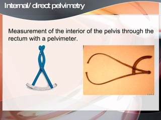 Pelvimetry, pelvic abnormalities,congenital defects of female rep.tract ...
