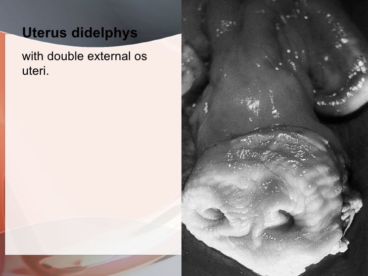 Pelvimetry, pelvic abnormalities,congenital defects of female rep.tra…