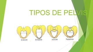 TIPOS DE PELVIS

 