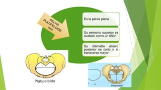 Es la pelvis plana

Su estrecho superior es
ovalado como un riñón

Su diámetro antero
posterior es corto y el
transverso mayor

 