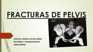 FRACTURAS DE PELVIS
HOSPITAL CENTRAL DE SAN ISIDRO
ORTOPEDIA Y TRAUMATOLOGIA
JAIME MESINO
 