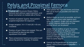 Comprehensive Guide to Pelvis and Proximal Femur X-Ray Techniques and ...