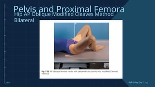 Comprehensive Guide to Pelvis and Proximal Femur X-Ray Techniques and ...