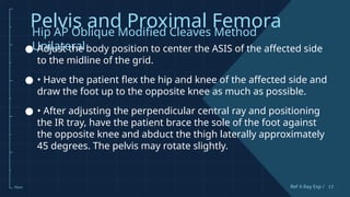 Comprehensive Guide to Pelvis and Proximal Femur X-Ray Techniques and ...