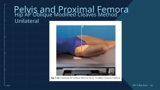 Comprehensive Guide to Pelvis and Proximal Femur X-Ray Techniques and ...