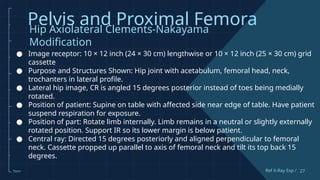 Clements Modification Comprehensive Guide to Pelvis and Proximal Femur X-Ray Techniques and ...