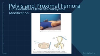 Clements Modification Comprehensive Guide to Pelvis and Proximal Femur X-Ray Techniques and ...