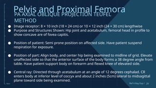 Comprehensive Guide to Pelvis and Proximal Femur X-Ray Techniques and ...